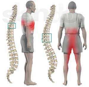 Раздел 3: Физические упражнения для снятия боли при грудном радикулите