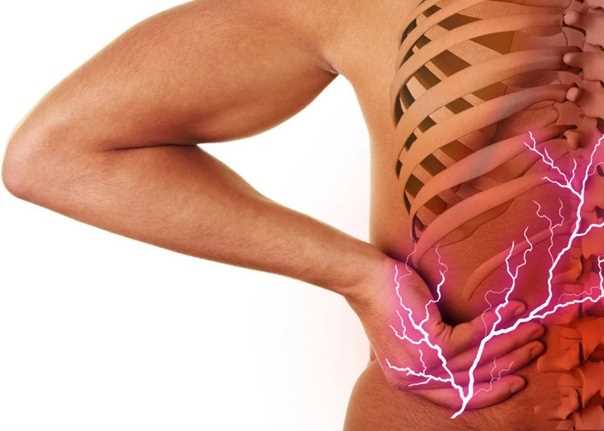 Как изучать физиотерапию грудного радикулита?