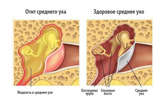 Возможные методы лечения онемения уха