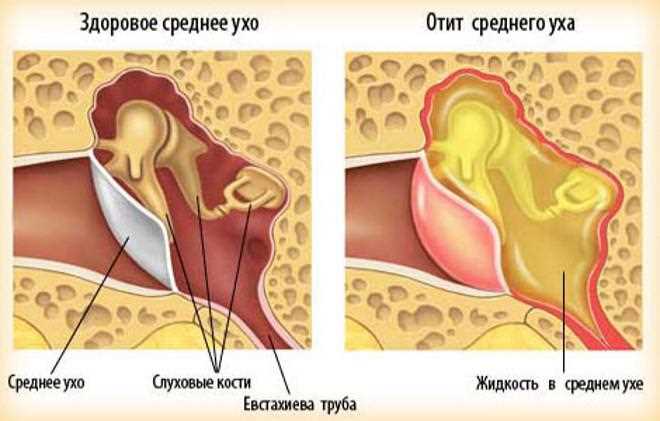 Как найти доступное лечение онемения уха