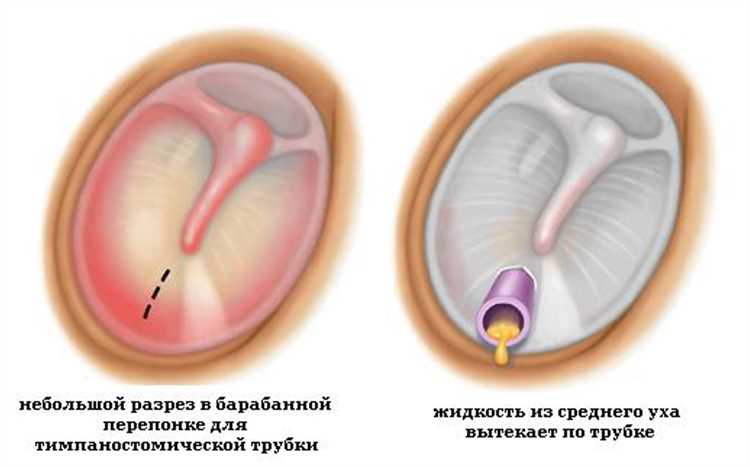 Основные способы лечения онемения уха