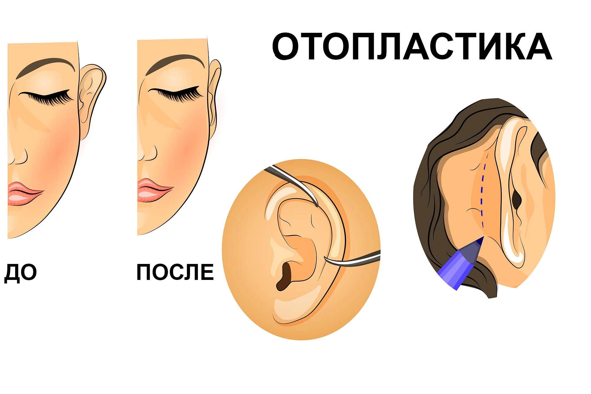 Какие существуют виды лечения онемения уха?