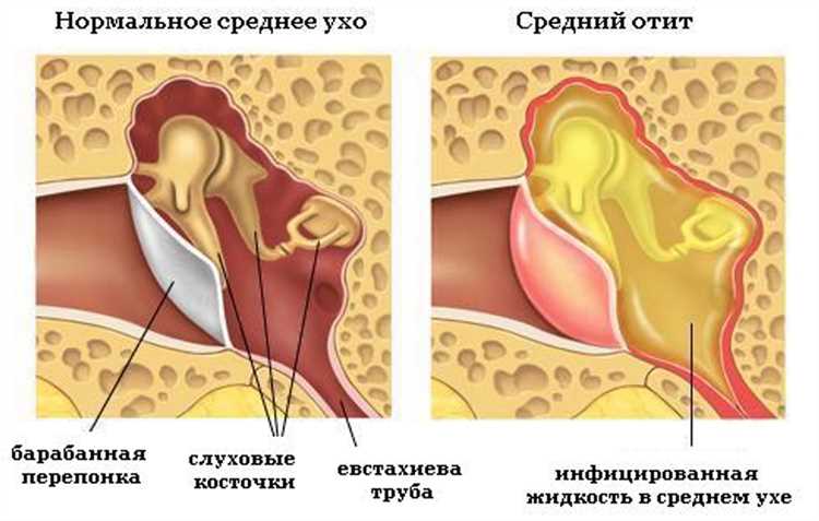 Лекарства для онемения уха: что назначают врачи?