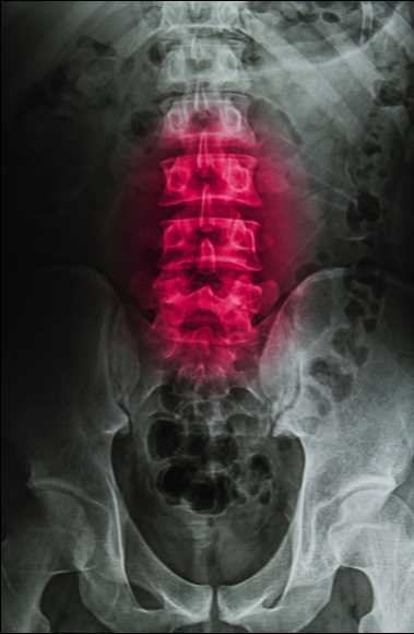 Возможности рентгеновской томографии