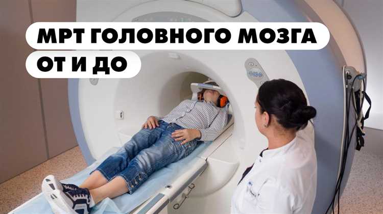 Преимущества МРТ при исследовании головного мозга