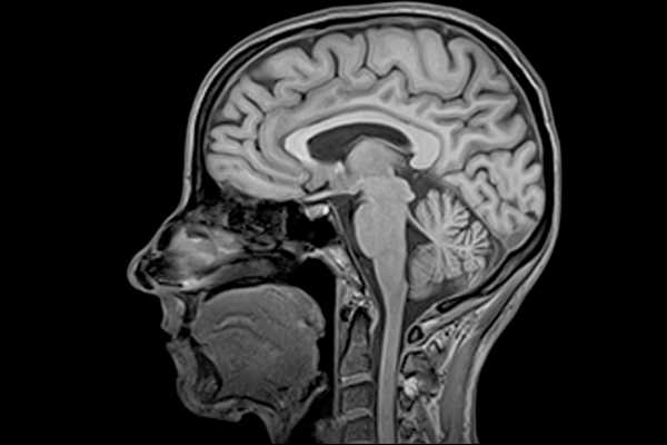 Вредно ли мрт головного мозга: особенности процедуры, преимущества метода